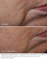 Vorher Nachher Daily Dynamic Hydrator Studie