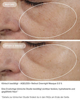 AGELESS+ Retinol - IMAGE SKincare - Overnight Masque 0,5% Retinol Complex vorher nachher ergebnisse