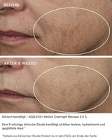 AGELESS+ Retinol - IMAGE SKincare - Overnight Masque 0,5% Retinol Complex vorher nachher ergebnisse