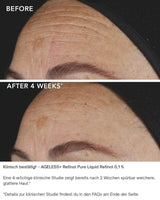 AGELESS+ Retinol IMAGE Skincare - pure liquid 0,1% vorher nachher ergebnisse