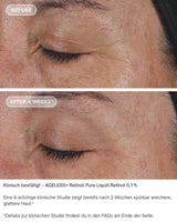AGELESS+ Retinol IMAGE Skincare - pure liquid 0,1% vorher nachher ergebnisse