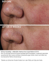 Pure Liquid Retinol 0,75 %