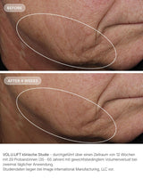 Vol.U.Lift von IMAGE Skincare - glp-1 4D skin rebound complex vorher nachher klinische ergebnisse