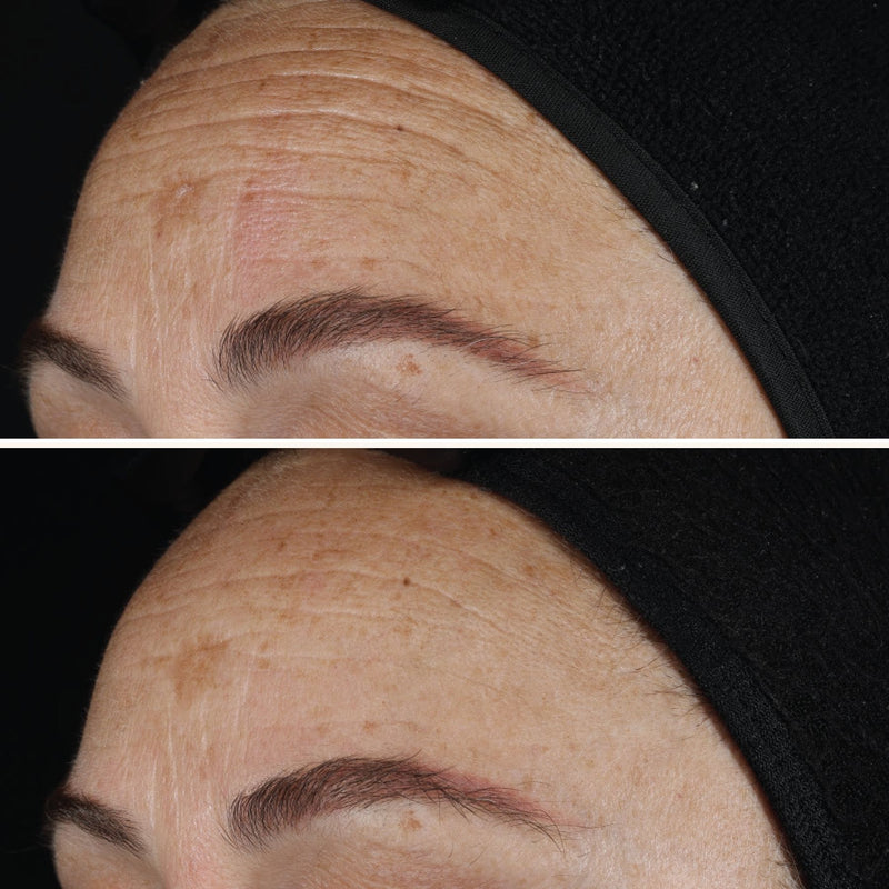 Ageless+ Retinol Pure Liquid Retinol 0,1 %