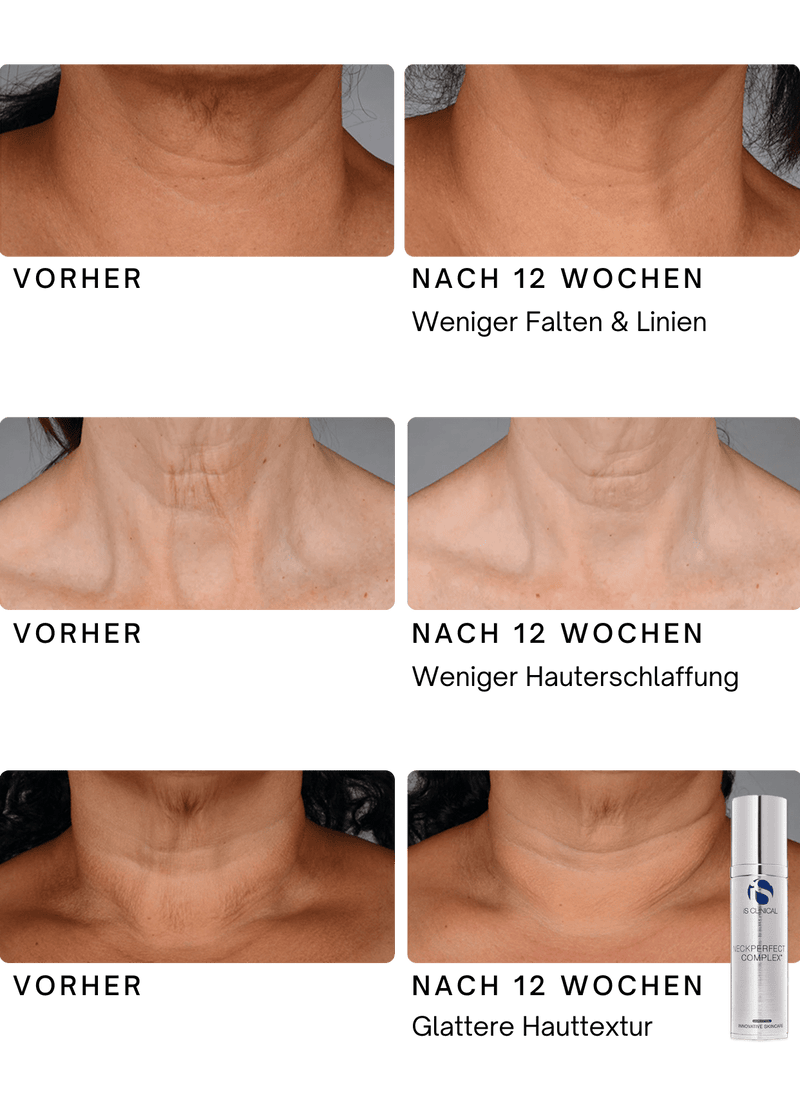 NeckPerfect Complex Vorher Nachher von iS Clinical