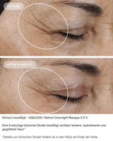 AGELESS+ Retinol - IMAGE SKincare - Overnight Masque 0,5% Retinol Complex vorher nachher ergebnisse