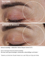 AGELESS+ Retinol - IMAGE SKincare - repair creme 0,3% vorher/nachher ergebnisse