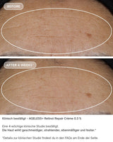 AGELESS+ Retinol - IMAGE SKincare - repair creme 0,3% vorher/nachher ergebnisse