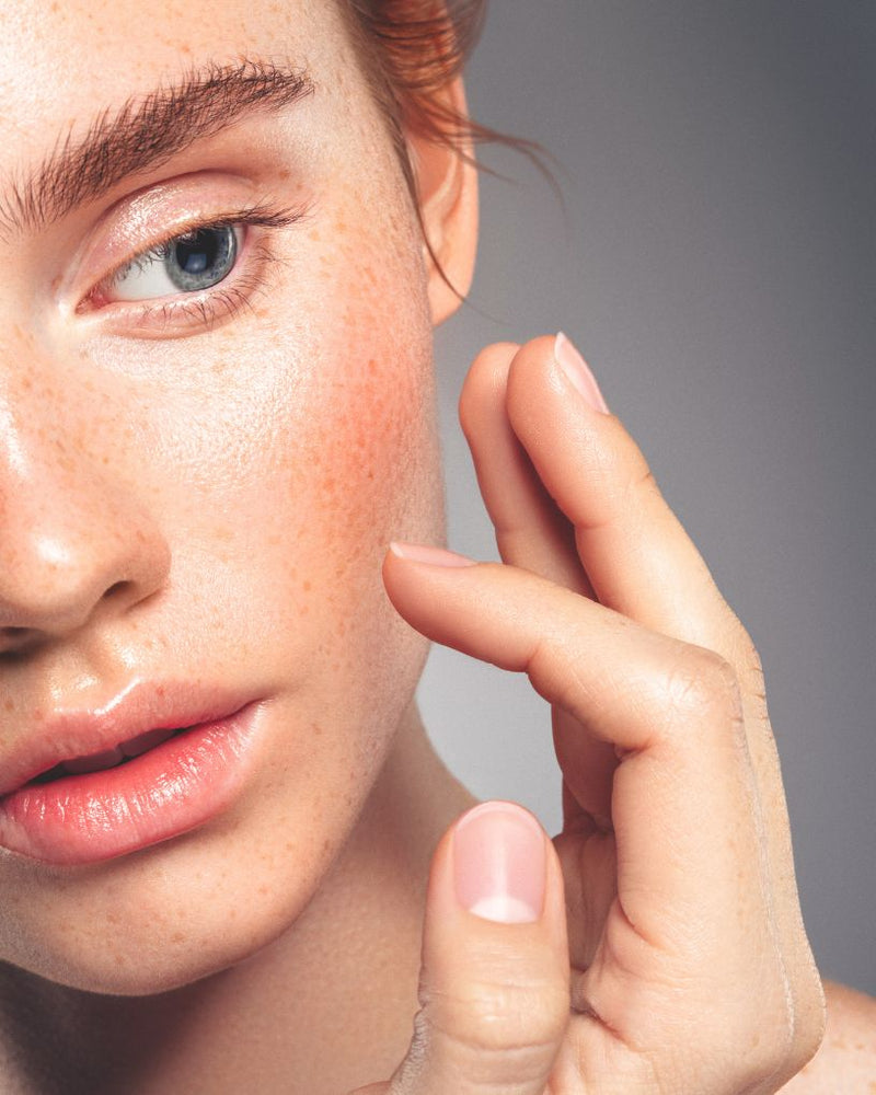 Skincare Model - Pigmentation Skin 