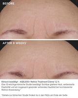 Treatment Crème 1,2 % Retinol Complex