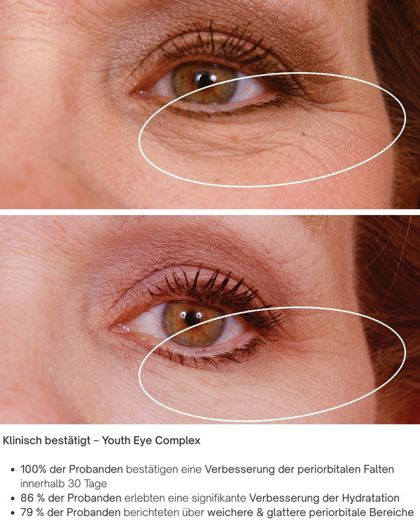 Youth Eye Complex