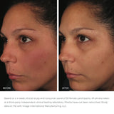 Ormedic Balancing Anti-Oxidant Serum